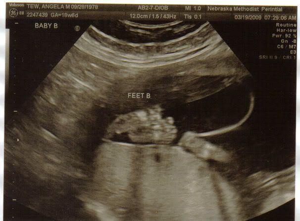Mar 19 B feet
