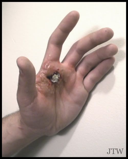 Makeup - Burn with Pus